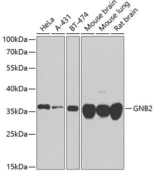 GNB2 Polyclonal Antibody (E-AB-62767)