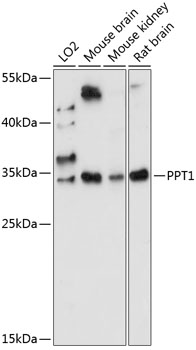 PPT1 Polyclonal Antibody (E-AB-90948)