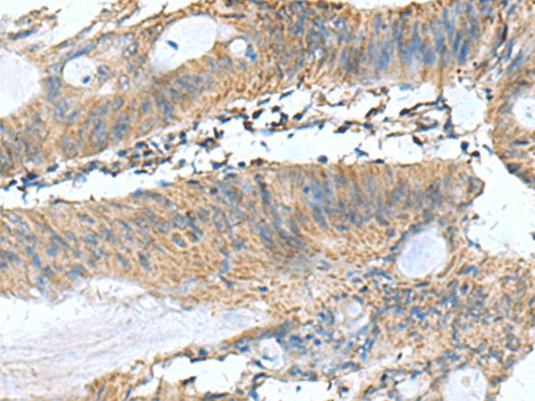 PAFAH1B3 Polyclonal Antibody (E-AB-53102)