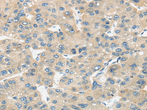 TIRAP Polyclonal Antibody (E-AB-17096)
