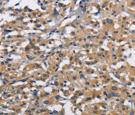 CBY1 Polyclonal Antibody (E-AB-14716)