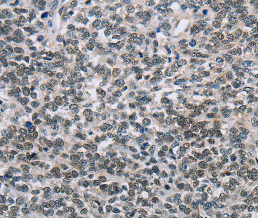 TONSL Polyclonal Antibody (E-AB-10088)