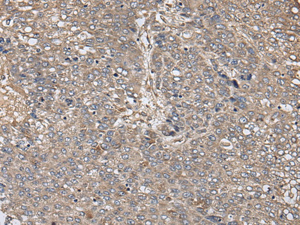 ZFP36 Polyclonal Antibody (E-AB-18447)