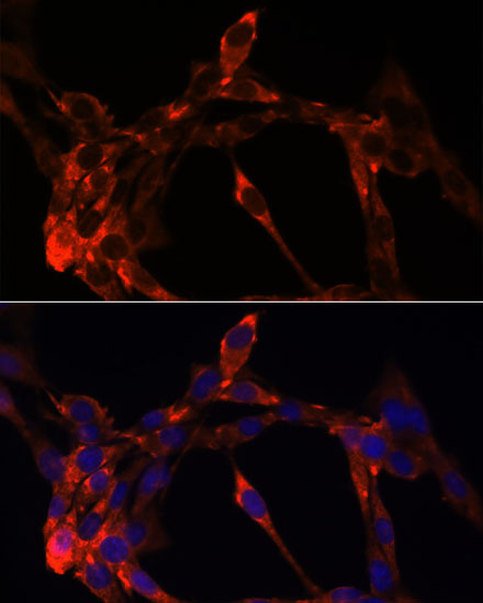 JAG1 Polyclonal Antibody (E-AB-65957)