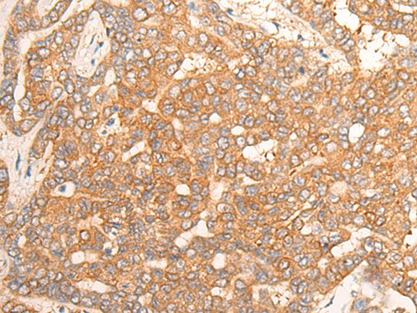 CPS1 Polyclonal Antibody (E-AB-19774)
