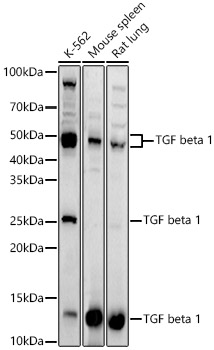 TGF beta 1 Polyclonal Antibody (E-AB-93274)