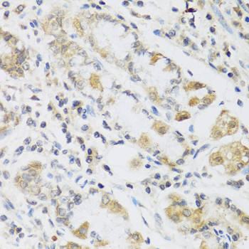 RETN Polyclonal Antibody (E-AB-67475)