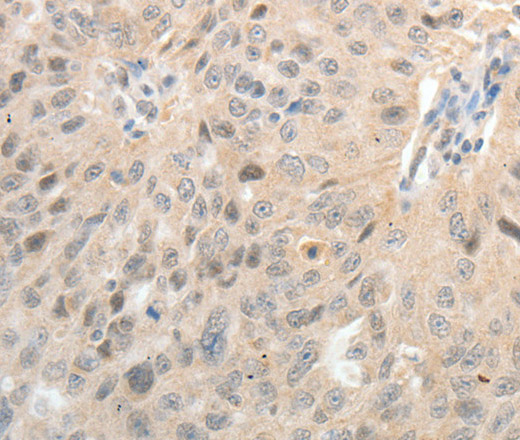 ASCL1 Polyclonal Antibody (E-AB-15516)