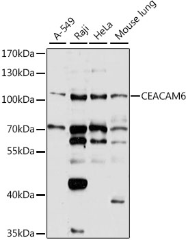 CEACAM6 Polyclonal Antibody (E-AB-92869)