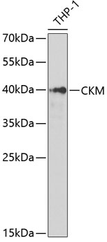 CKM Polyclonal Antibody (E-AB-62678)