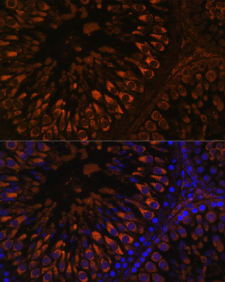 FER1L5 Polyclonal Antibody (E-AB-66628)