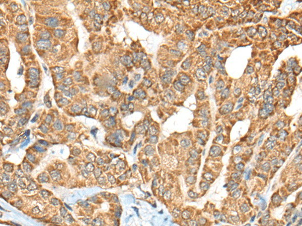 C1R Polyclonal Antibody (E-AB-18567)
