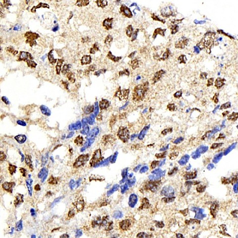 IkB alpha Polyclonal Antibody (E-AB-70089)