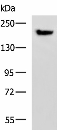 PDS5B Polyclonal Antibody (E-AB-52178)