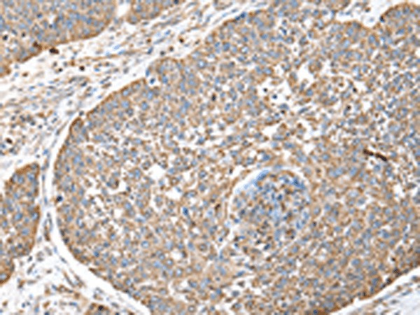 DPH7 Polyclonal Antibody (E-AB-52235)
