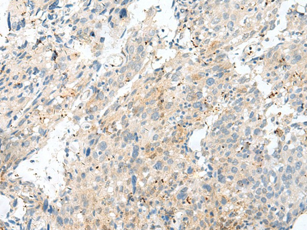NXNL1 Polyclonal Antibody (E-AB-52711)