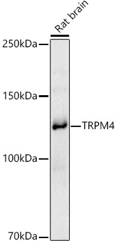 TRPM4 Polyclonal Antibody (E-AB-90090)