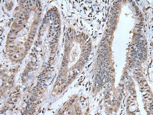 UBA52 Polyclonal Antibody (E-AB-19594)