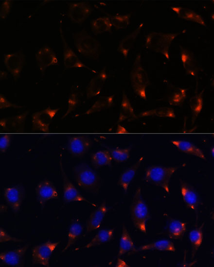 NOS1 Polyclonal Antibody (E-AB-64331)