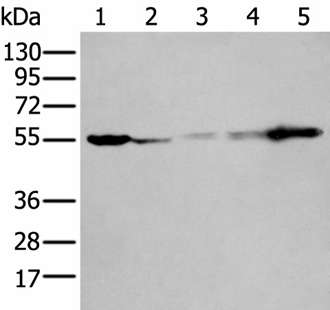 PFKFB3 Polyclonal Antibody (E-AB-19543)