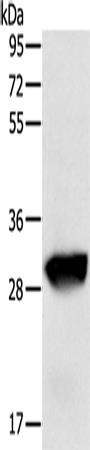 GSTO1 Polyclonal Antibody (E-AB-11285)