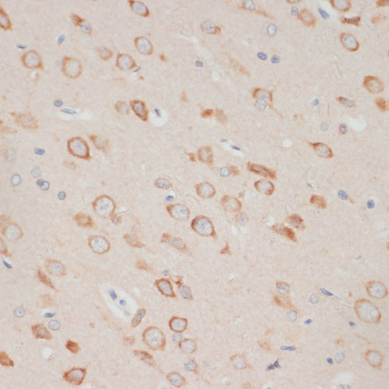 AXIN2 Polyclonal Antibody (E-AB-67467)