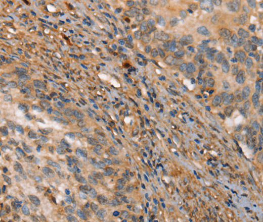 HK3 Polyclonal Antibody (E-AB-10928)