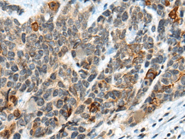 ATRX Polyclonal Antibody (E-AB-19609)