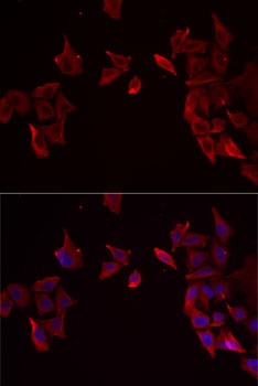 RAMP3 Polyclonal Antibody (E-AB-61320)