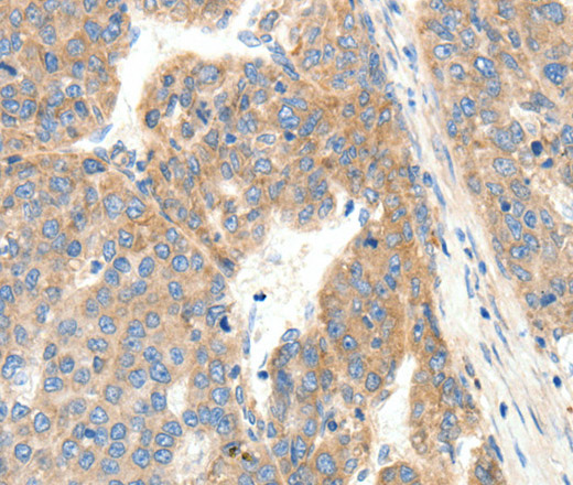 COL4A1 Polyclonal Antibody (E-AB-15566)