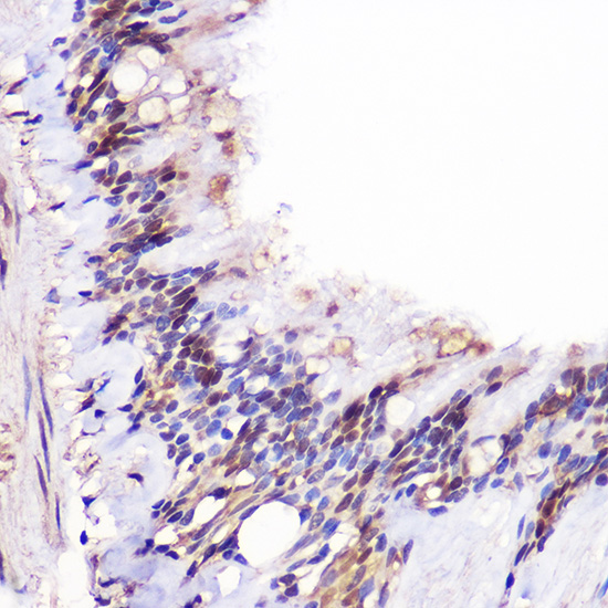 JMJD6 Polyclonal Antibody (E-AB-92435)
