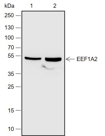 Recombinant eEF1A2 Monoclonal Antibody (AN301979L)