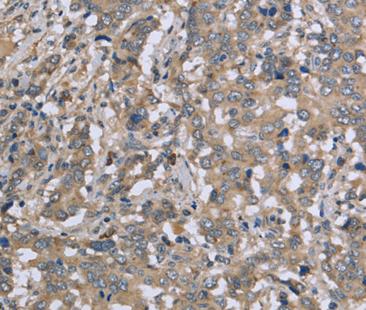 DTNB Polyclonal Antibody (E-AB-14963)