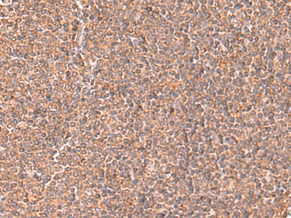 RABEPK Polyclonal Antibody (E-AB-52917)