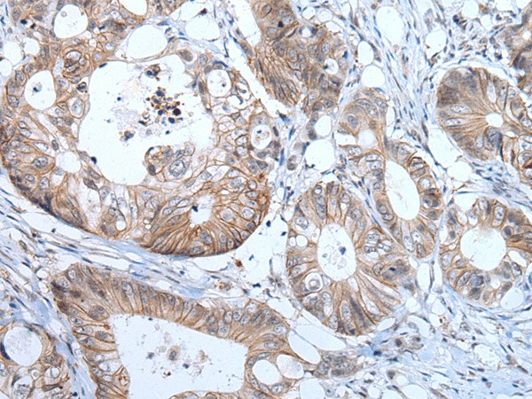 PRSS50 Polyclonal Antibody (E-AB-53609)
