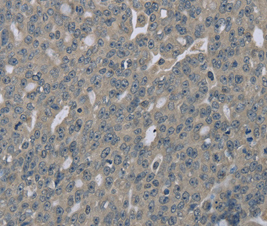 EDN1 Polyclonal Antibody (E-AB-11197)