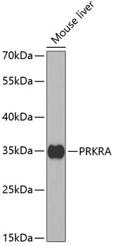 PRKRA Polyclonal Antibody (E-AB-60958)