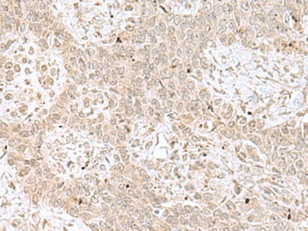 RPL35 Polyclonal Antibody (E-AB-19108)
