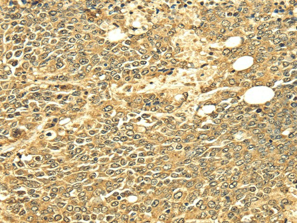 ECE2 Polyclonal Antibody (E-AB-16986)