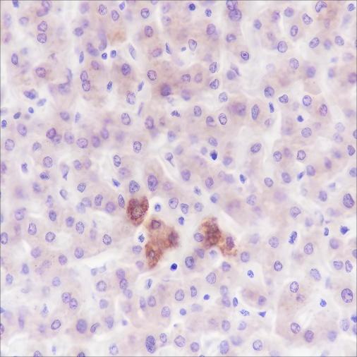 Recombinant PDK1 Monoclonal Antibody (AN301622L)