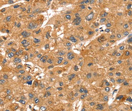 SPTAN1 Polyclonal Antibody (E-AB-13691)