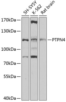 PTPN4 Polyclonal Antibody (E-AB-92566)