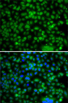 PHYHD1 Polyclonal Antibody (E-AB-61585)