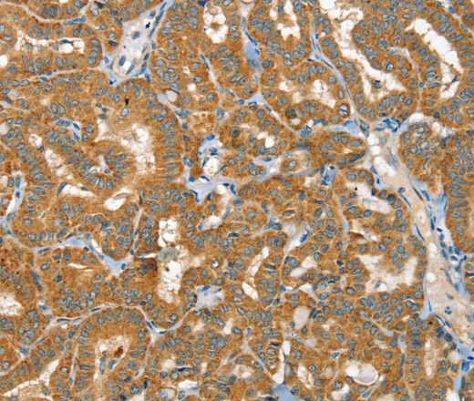 RAB25 Polyclonal Antibody (E-AB-15322)