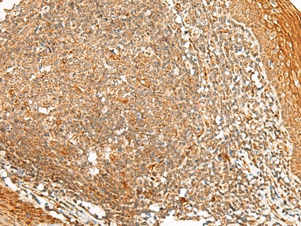 PPOX Polyclonal Antibody (E-AB-52754)