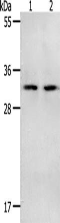 NME6 Polyclonal Antibody (E-AB-14250)
