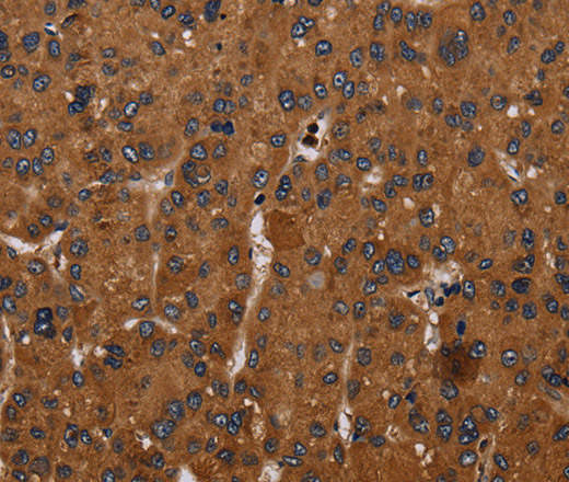 CYBB Polyclonal Antibody (E-AB-16654)