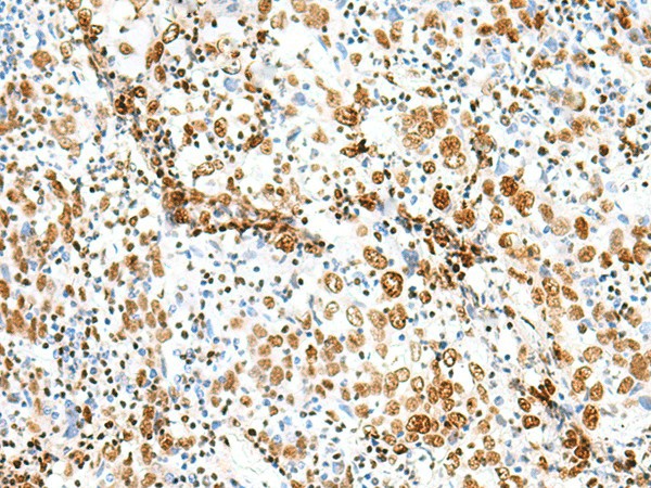 TCOF1 Polyclonal Antibody (E-AB-52784)