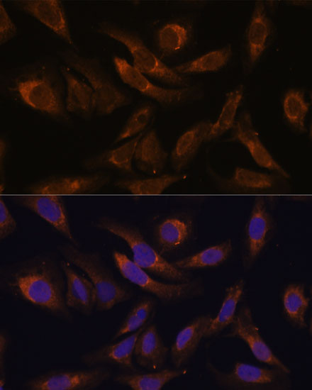 SOCS2 Polyclonal Antibody (E-AB-67026)