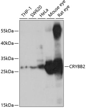 CRYBB2 Polyclonal Antibody (E-AB-92654)